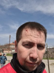 Meslektaşımıza geçmiş olsun dileklerimizi sunuyoruz.